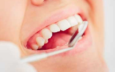 cosmetic restorations