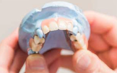 dentures & partials