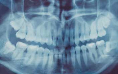 oral surgery