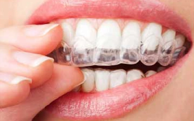 orthodontics