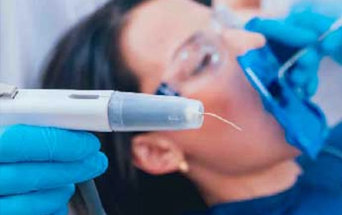 root canals treatment