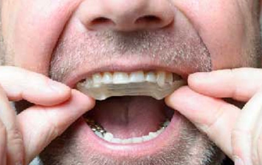 sleep apnea treatment
