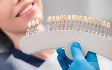 veneers, onlays, inlays, crowns & bridges